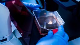 Close up of a microscope with gloved hands holding a glass container