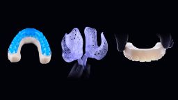 H3D AI-driven design for dental devices