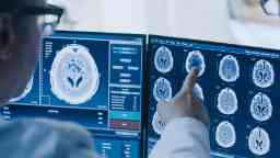 A doctor analyses brain scans for patterns on computer monitors.